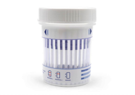Urine Test
